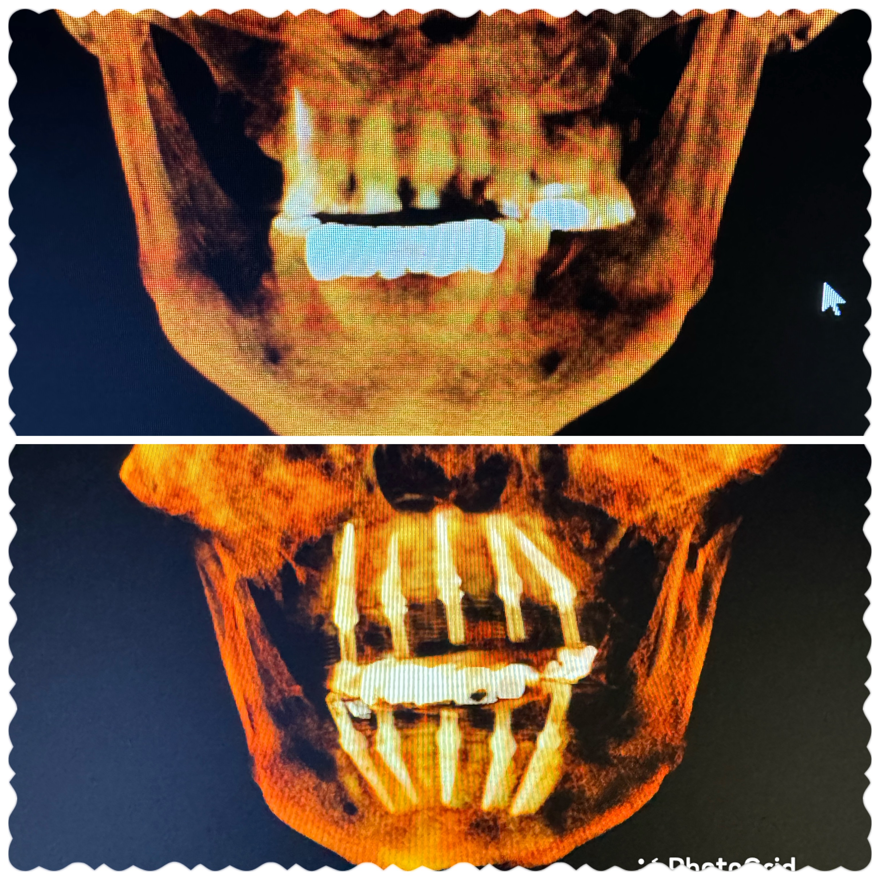 AOX Surgery at Your Office